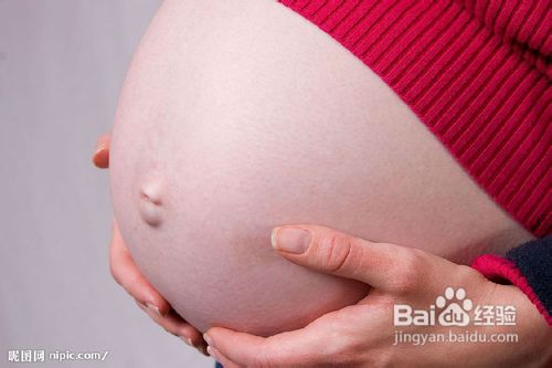 产后如何去掉妊娠纹