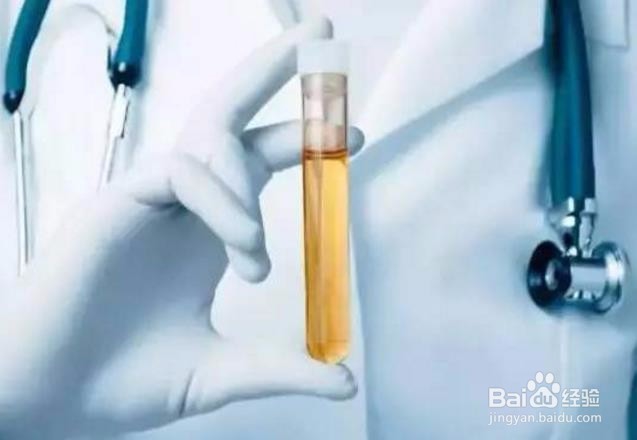 如何从尿的颜色可以判断人的健康状况吗？