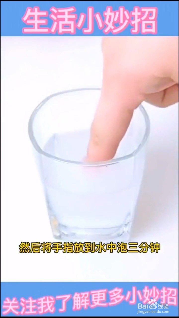 手指扎刺怎么办