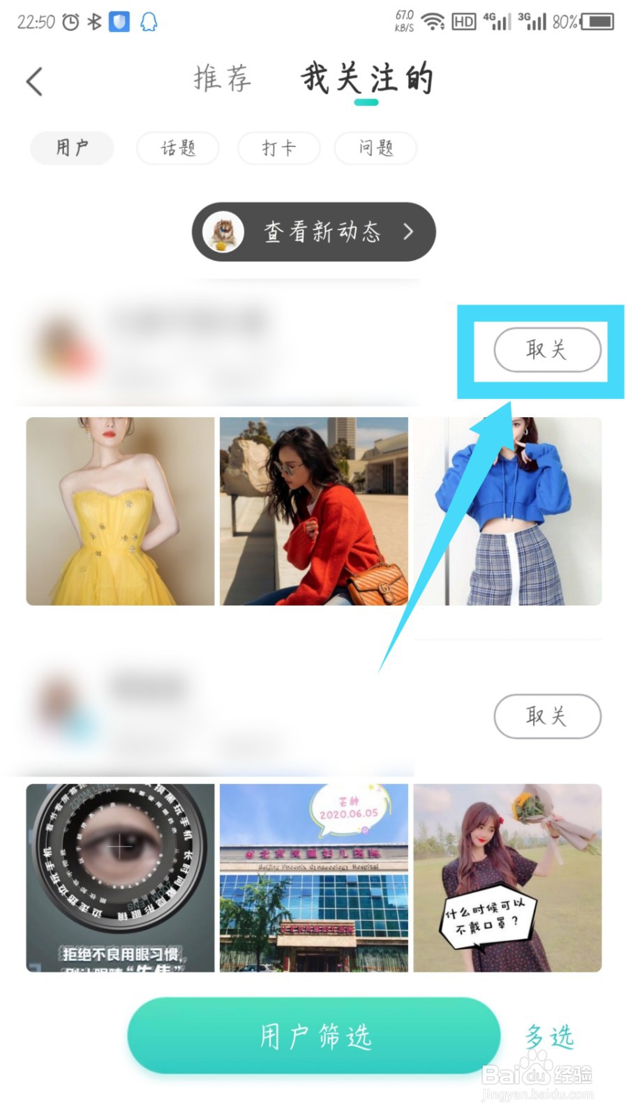 新氧医美怎么取消关注