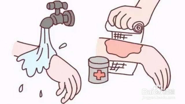 老人烫伤的处理方法