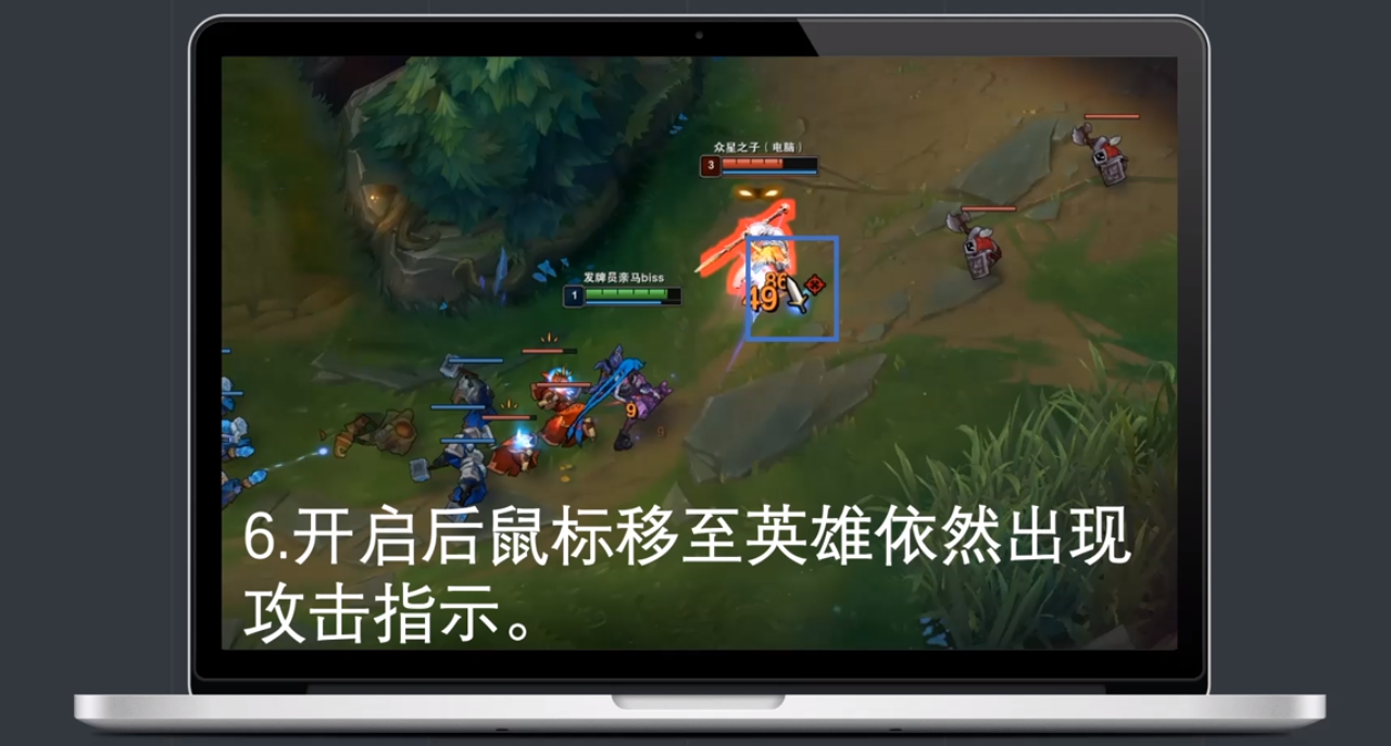 英雄联盟怎么设置只攻击英雄