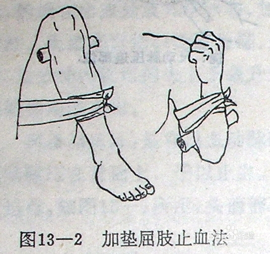 交通事故处置与伤员自救、急救