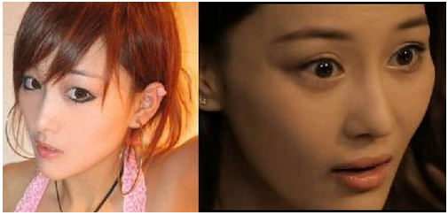 双眼皮手术(重睑术)适合哪些人群