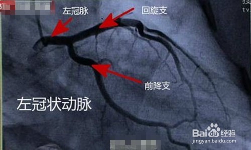 诊断晕厥有什么方法?