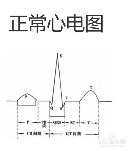 心电图看图步骤口诀是什么