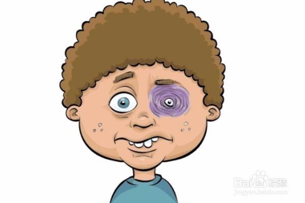 黑眼圈是由哪些因素导致的?