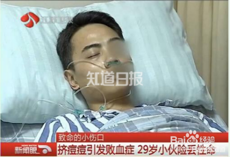 挤痘痘真的会死人吗？