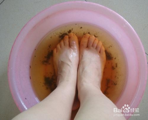 夏天如何预防脚臭？