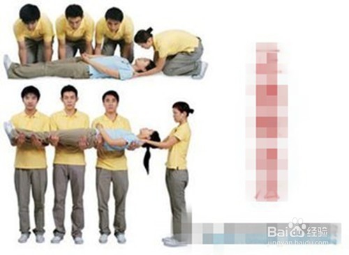 跌倒骨折，怎样正确处置