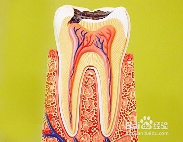 牙齿根管治疗后，为何还痛？