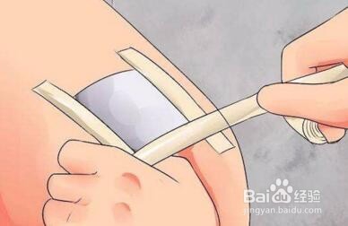 伤口缝针后怎么保养？