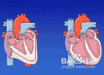 影响高血压的三个炸弹！