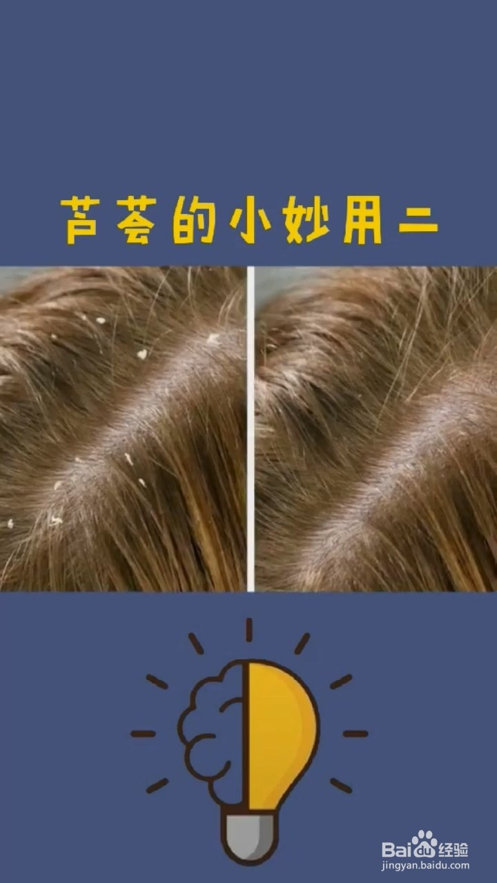 芦荟的小妙用