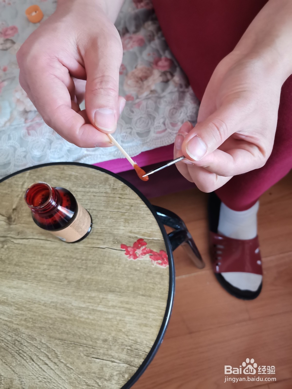 如何挑破脚上的大水泡