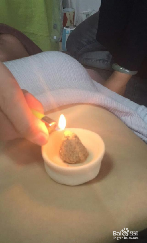 分享小儿推拿和艾灸治疗鼻炎的经验