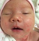 婴幼儿常见问题