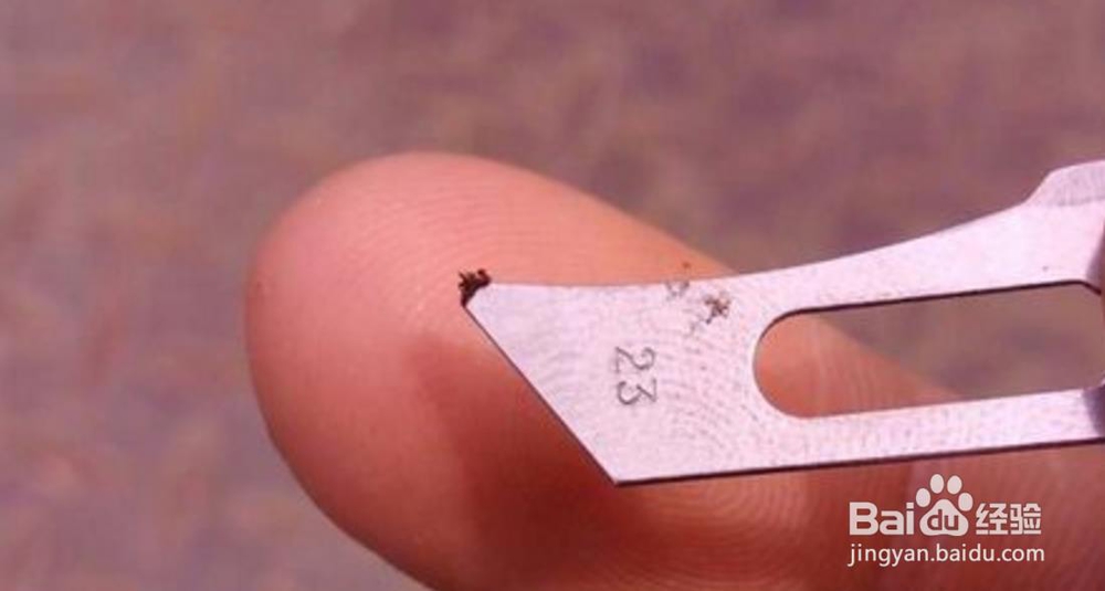 苹果手机喇叭怎么清理