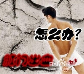 便血的护理秘诀