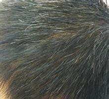 青少年怎样预防白头呢？