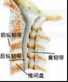 白领如何预防颈椎病