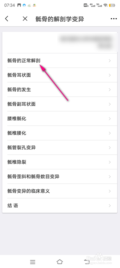 怎么查看3Dbody骶骨解刨变异