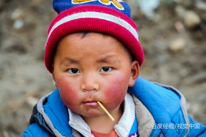 宝宝皮肤痒老抓怎么办