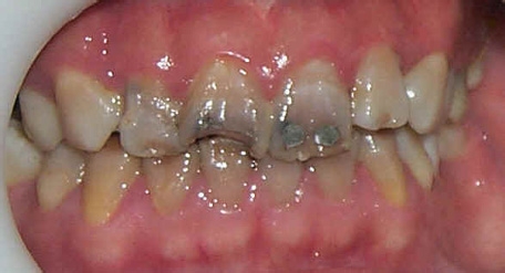 宝宝要不要睡觉前吃奶喂奶