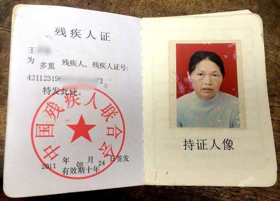 一只眼睛看不见可以办理残疾证吗