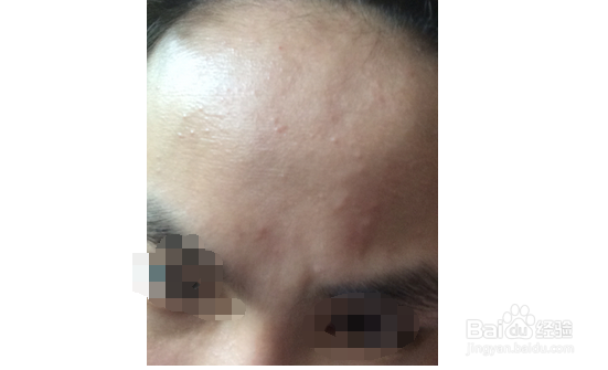 男人肝不好有什么症状