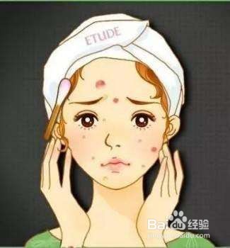 .脸上长痘痘的妹纸怎么去除痘痘？