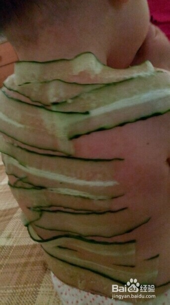 宝宝长痱子怎么办/怎么解决