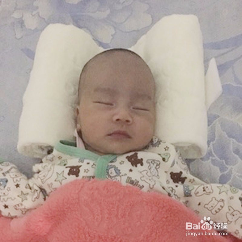 宝宝偏头能不能使用定型枕？使用什么样的枕头？