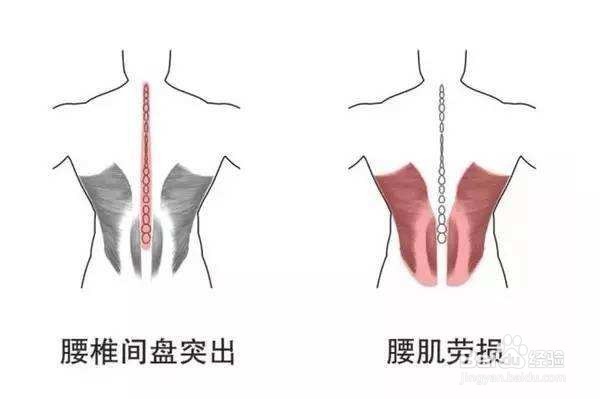 缓解腰痛 一个蝗虫式就可以解决吗 太天真了