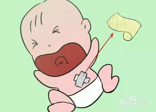 新生宝宝的脐带如何护理
