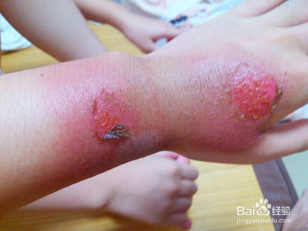 沙棘怎么吃?沙棘有哪些功效与作用?