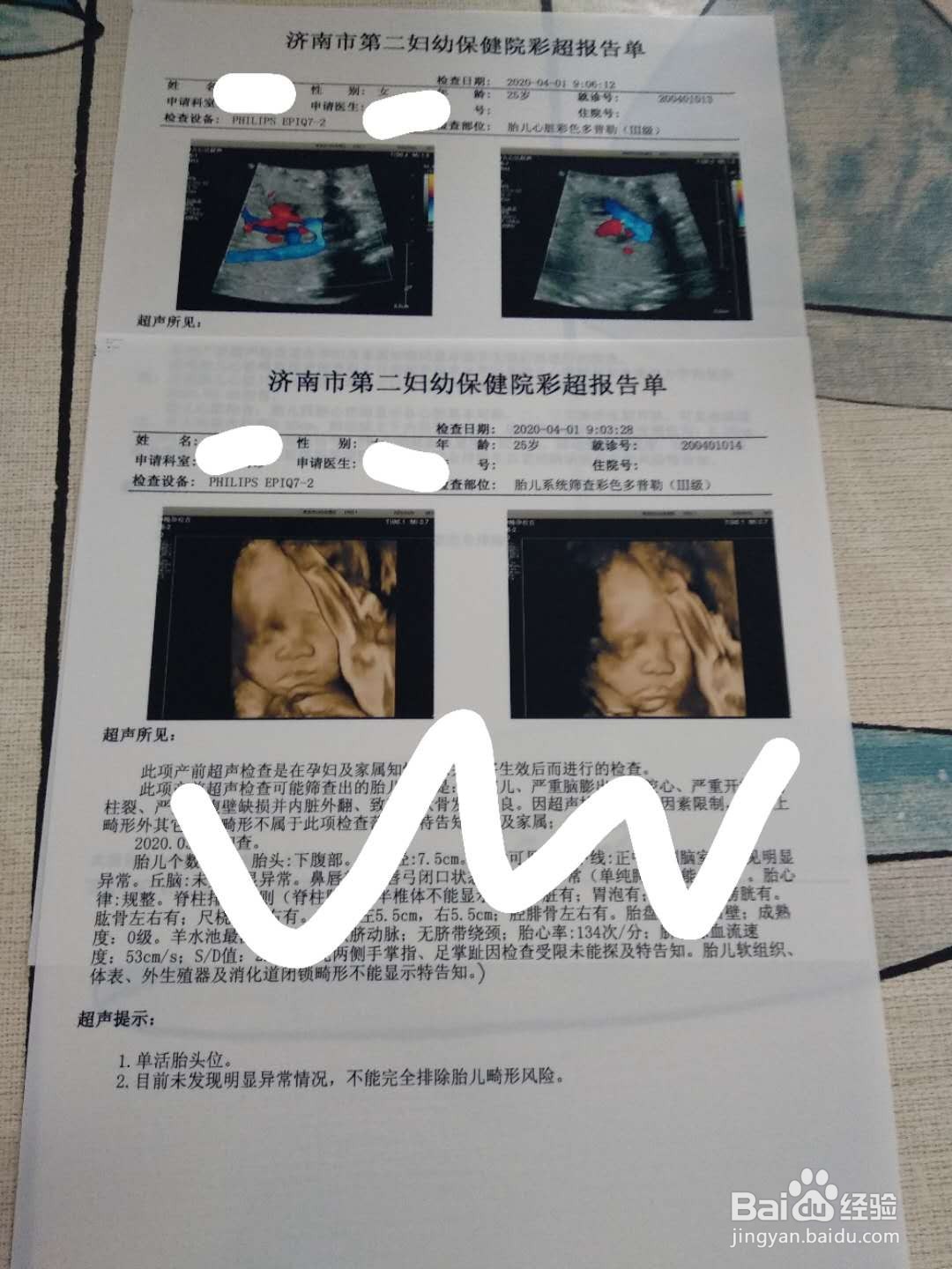 孕期产检内容及对应的时间表