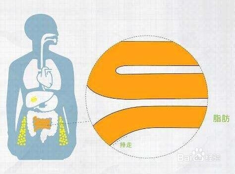 浆细胞性乳腺炎患者的饮食禁忌！
