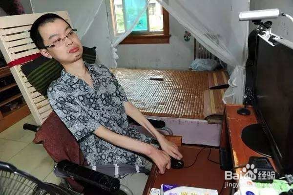 详解重症肌无力的常见症状