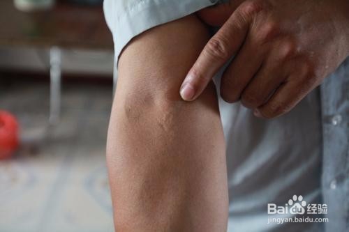 献血前后的注意事项有哪些呢?