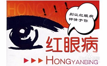 红眼病的症状及预防方法