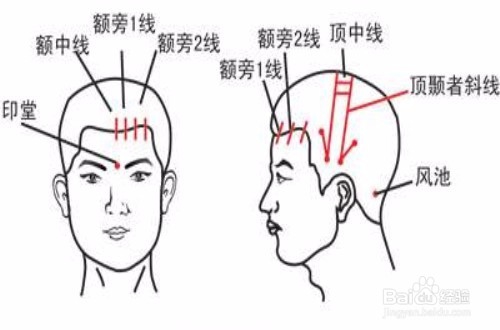 ”十指梳头“的好处,怎么做”十指梳头
