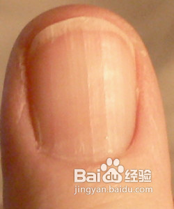 肝脏毒素表现及排泄方法