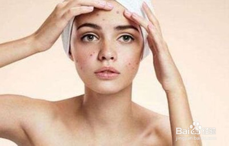 皮肤深层痘菌怎么清除