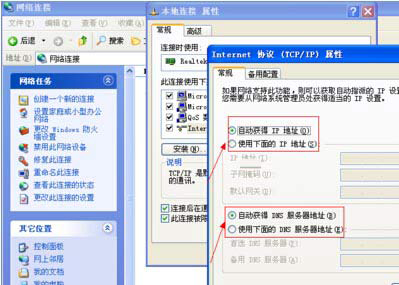 如何将电脑的IP地址设置为自动获取