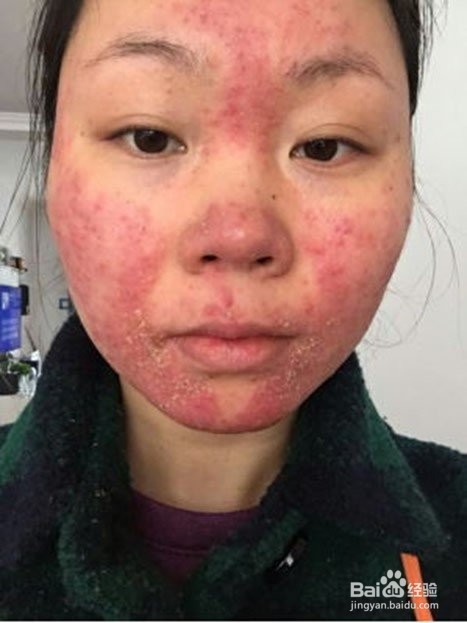 皮肤不好怎么办