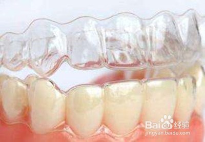 保持器分几种？