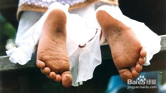 脚臭反反复复是什么原因?如何去除脚臭?