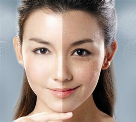 一杯白开水搞定9种病 餐后半小时喝水防肥胖