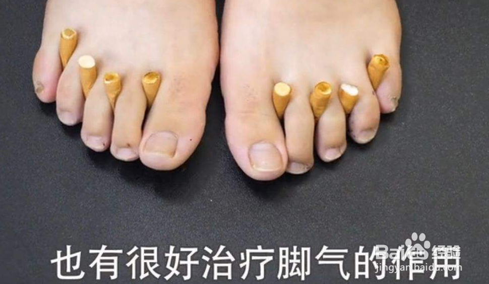 夏天怎么治脚气，治脚气简单实用偏方